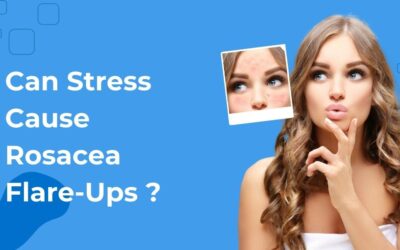 Can Stress Cause Rosacea Flare-Ups