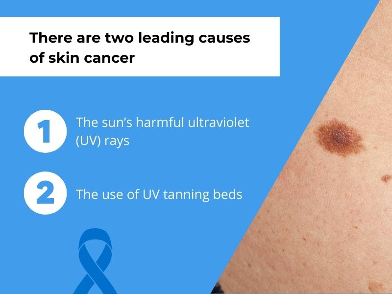 There are two leading causes of skin cancer