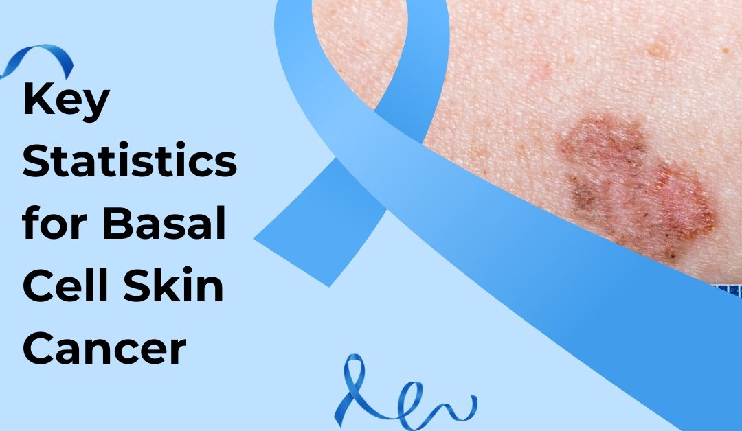 Key Statistics for Basal Cell Skin Cancer