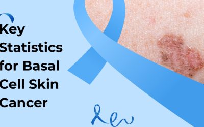 Key Statistics for Basal Cell Skin Cancer