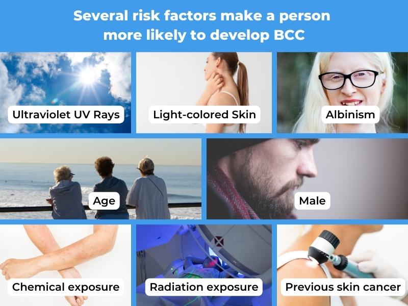 Risk factors for developing BCC