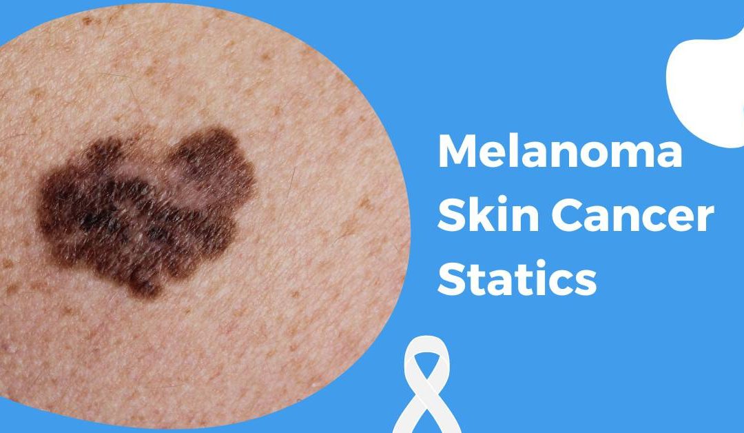 Melanoma Skin Cancer Statics