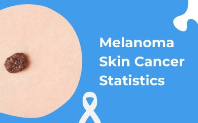 Melanoma Skin Cancer Statistics