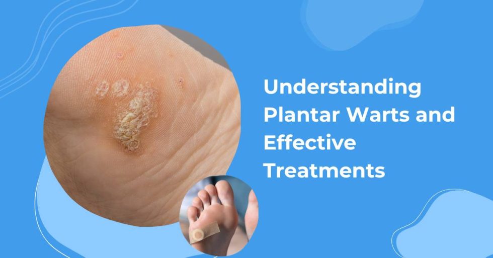 Plantar Warts Causes Symptoms And Treatment RTLNEL