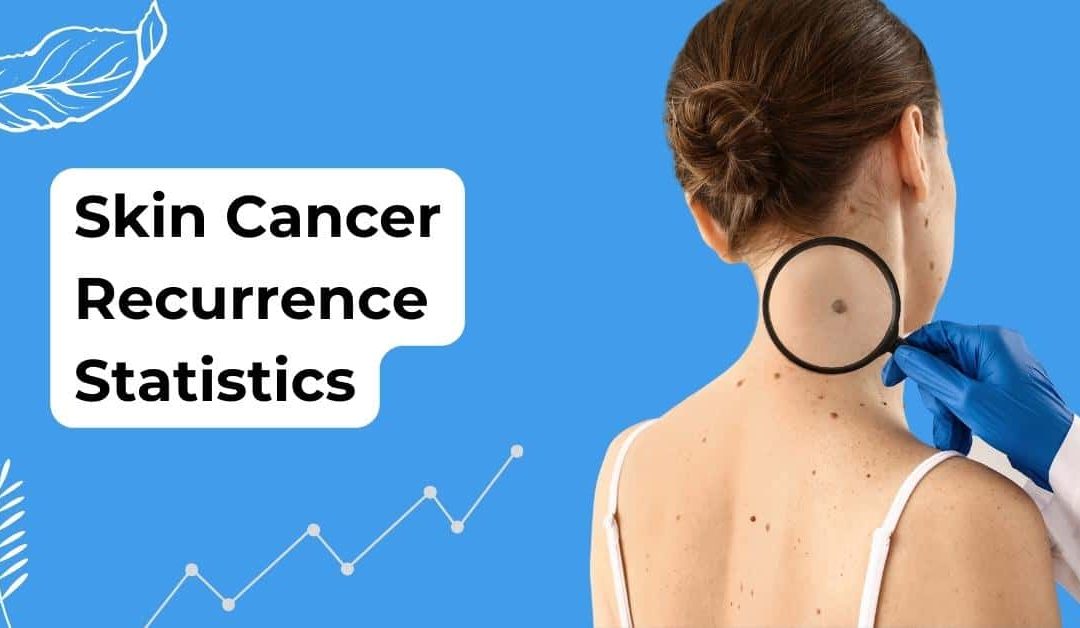 Unmasking Skin Cancer Recurrence Statistics