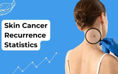 Unmasking Skin Cancer Recurrence Statistics