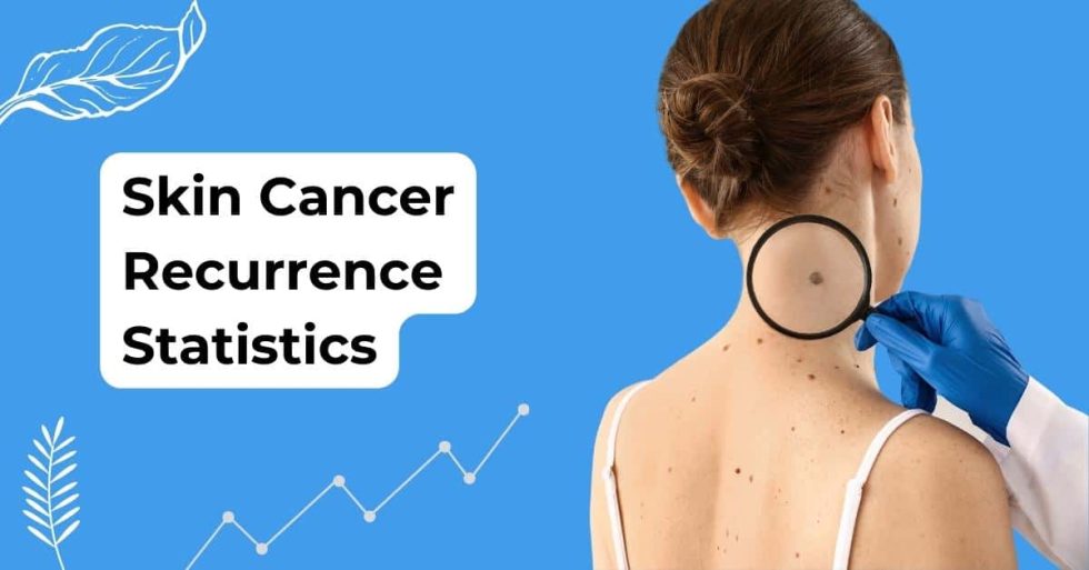 Unmasking Skin Cancer Recurrence Statistics Associated Dermatologists